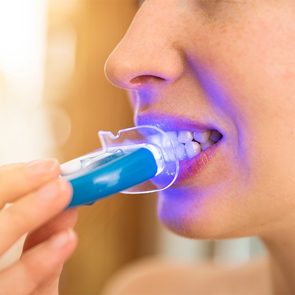 At-Home Teeth Whitening Service