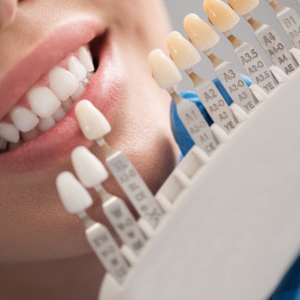 Veneer being held up to smile