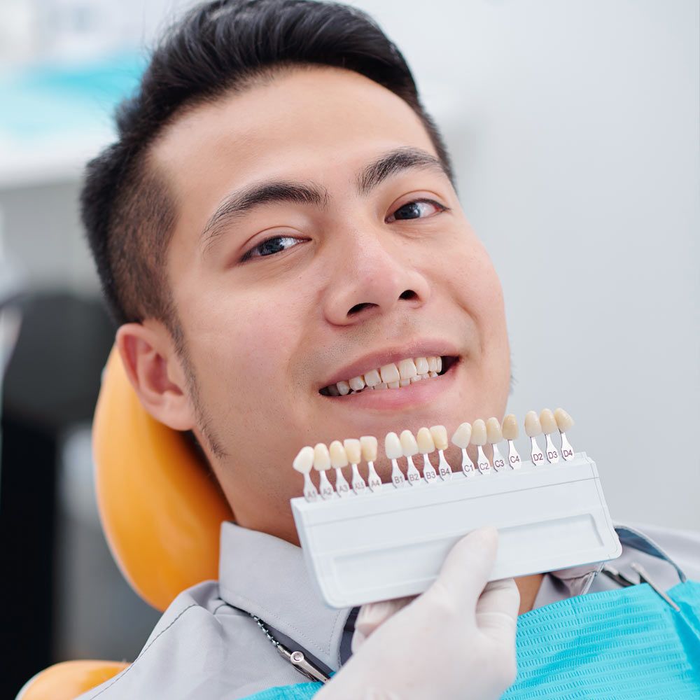 Smiling man with veneers shade guide