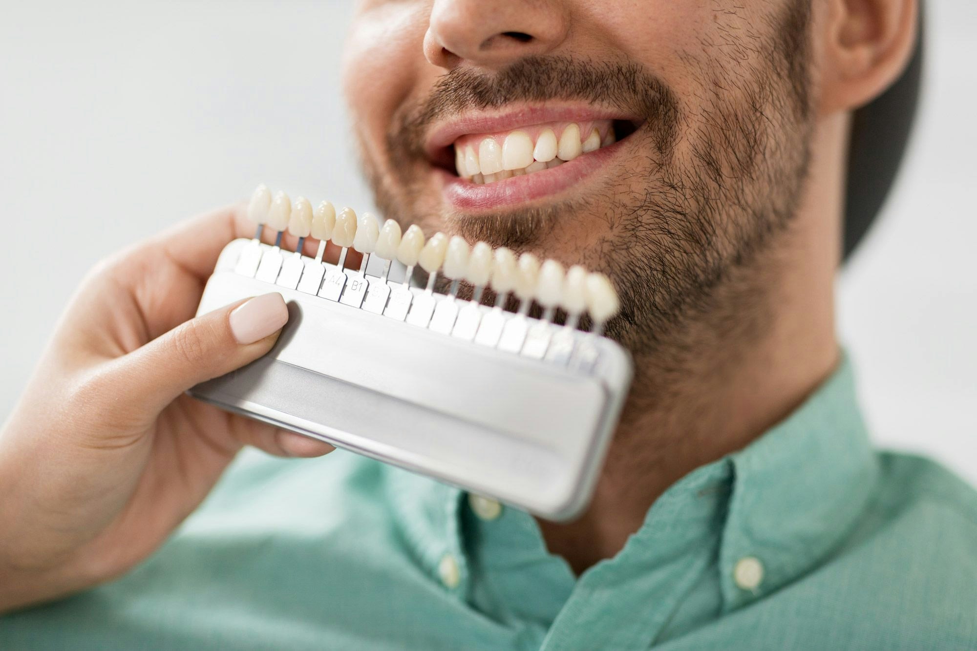 smiling man with veneers held by dental assistant