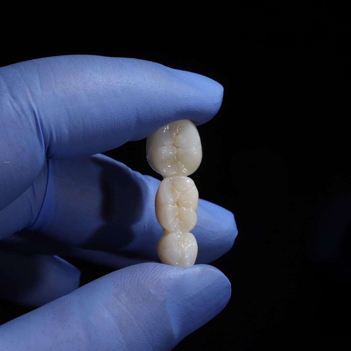 close up of zirconia crowns