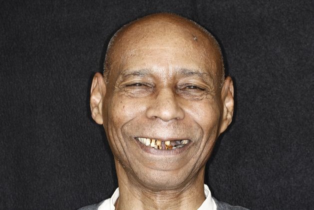 before dental implants