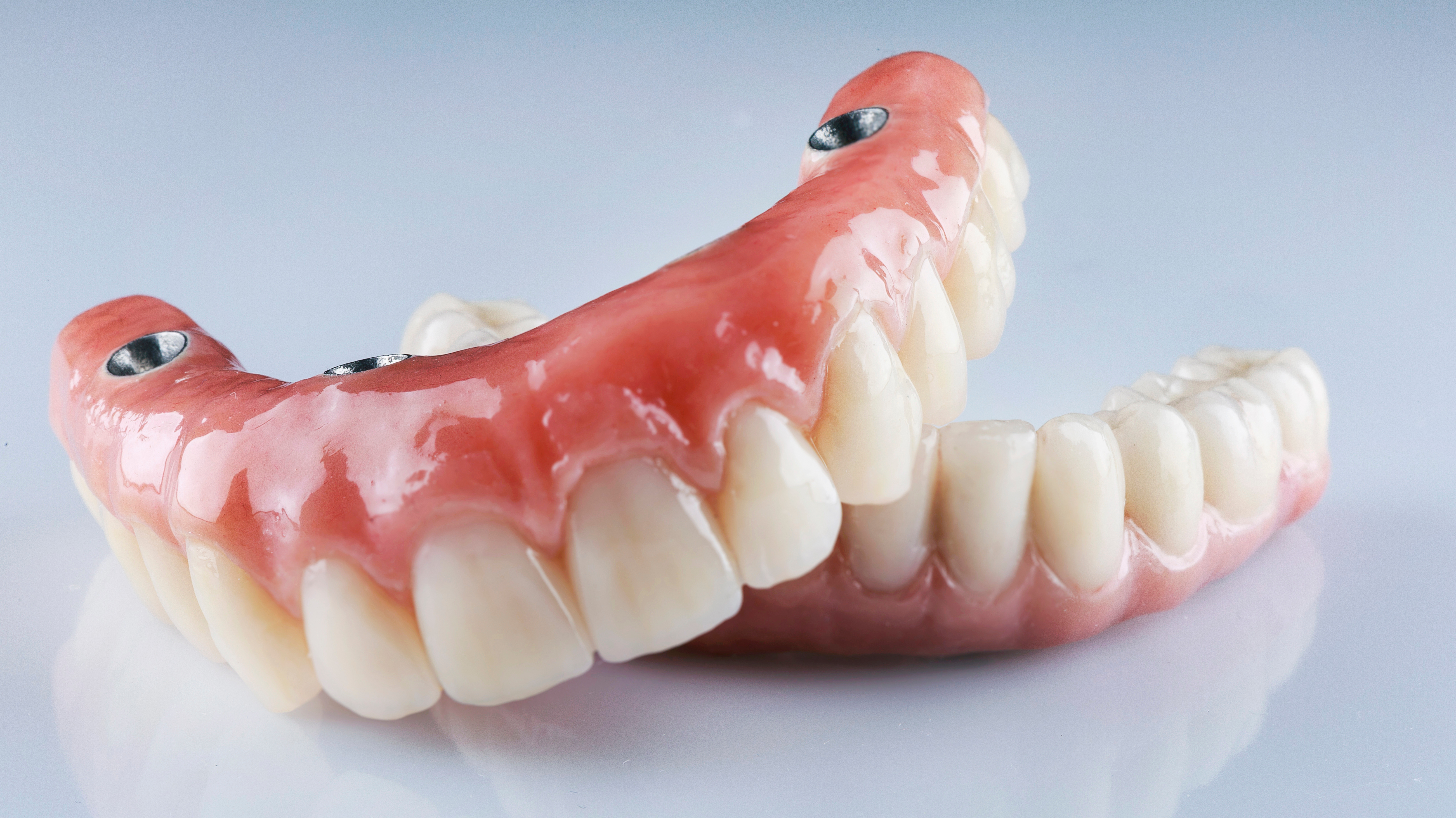 Implant dentures
