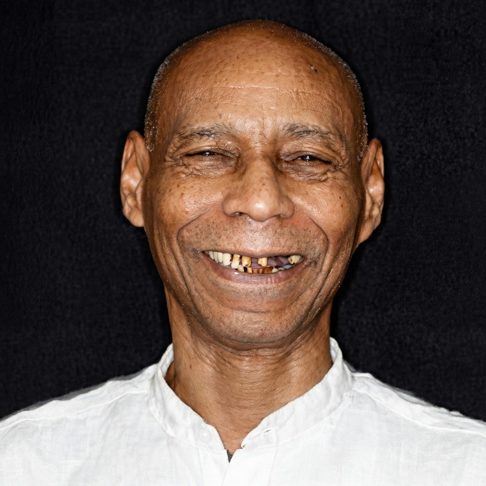 Before dental implants