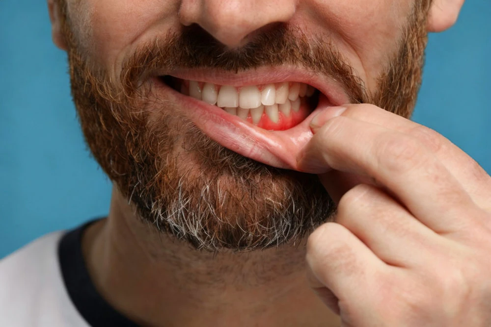 Man showing gums
