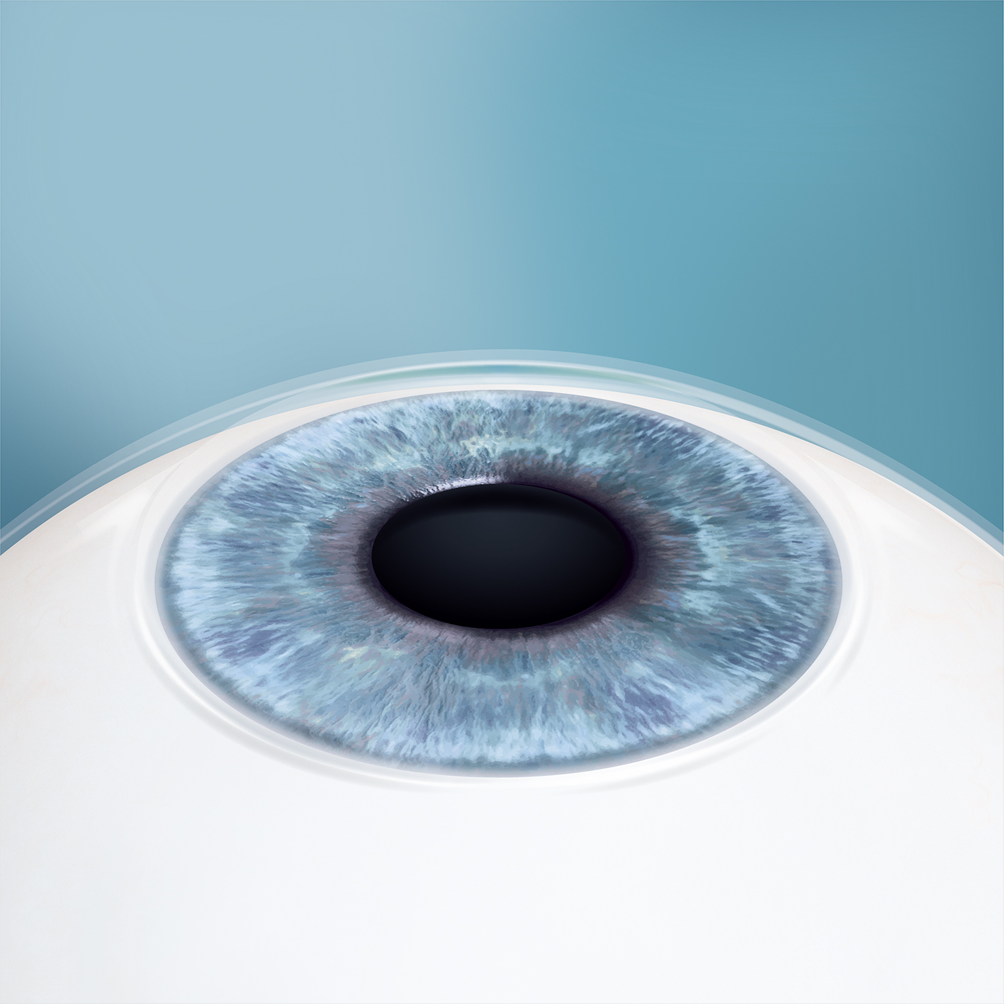 EVO ICL Dallas - Fort Worth - Plano - Implantable Collamer Lens ...