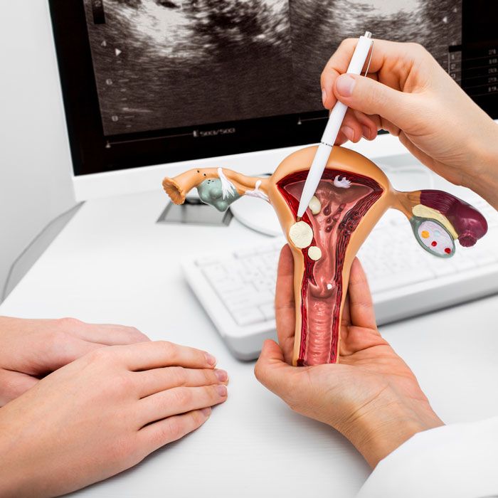 Model of a uterus with imaging in the background