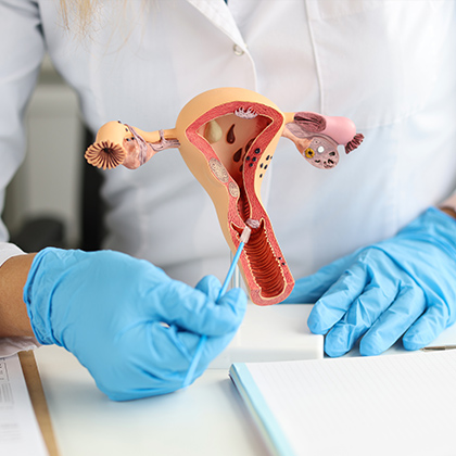 Lincoln fertility specialist using model to explain uterine surgery