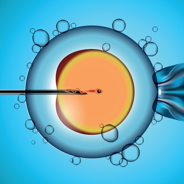 Illustration of IVF