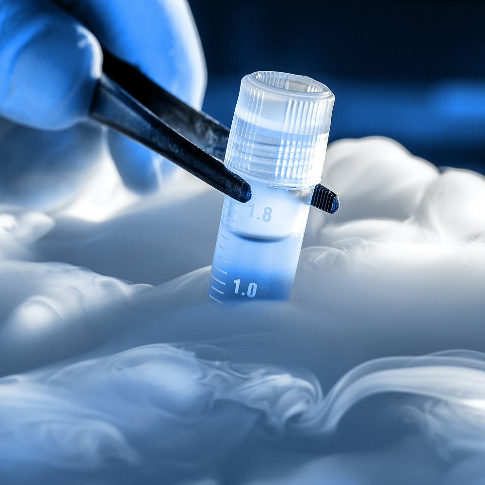 Frozen sperm in liquid nitrogen