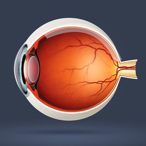 Retinal Detachment