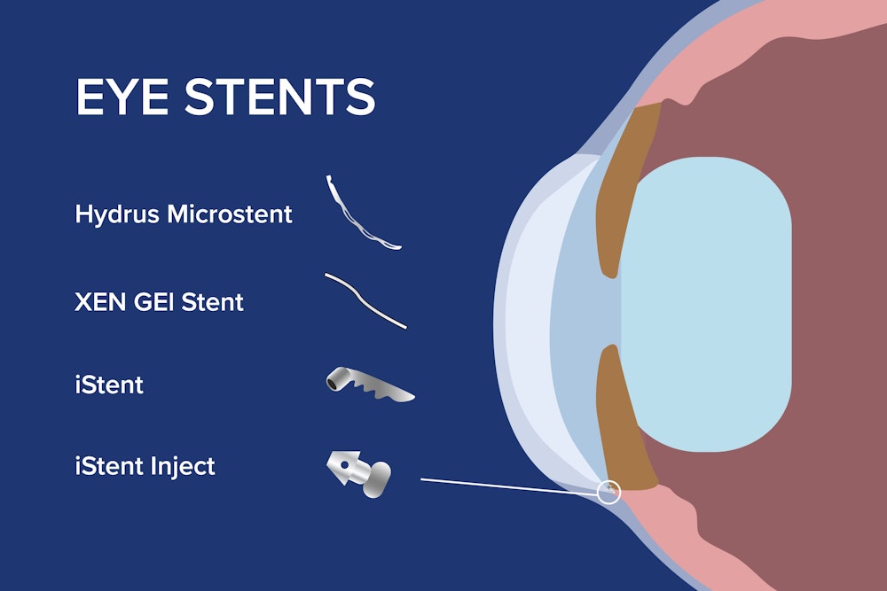 Eye stents