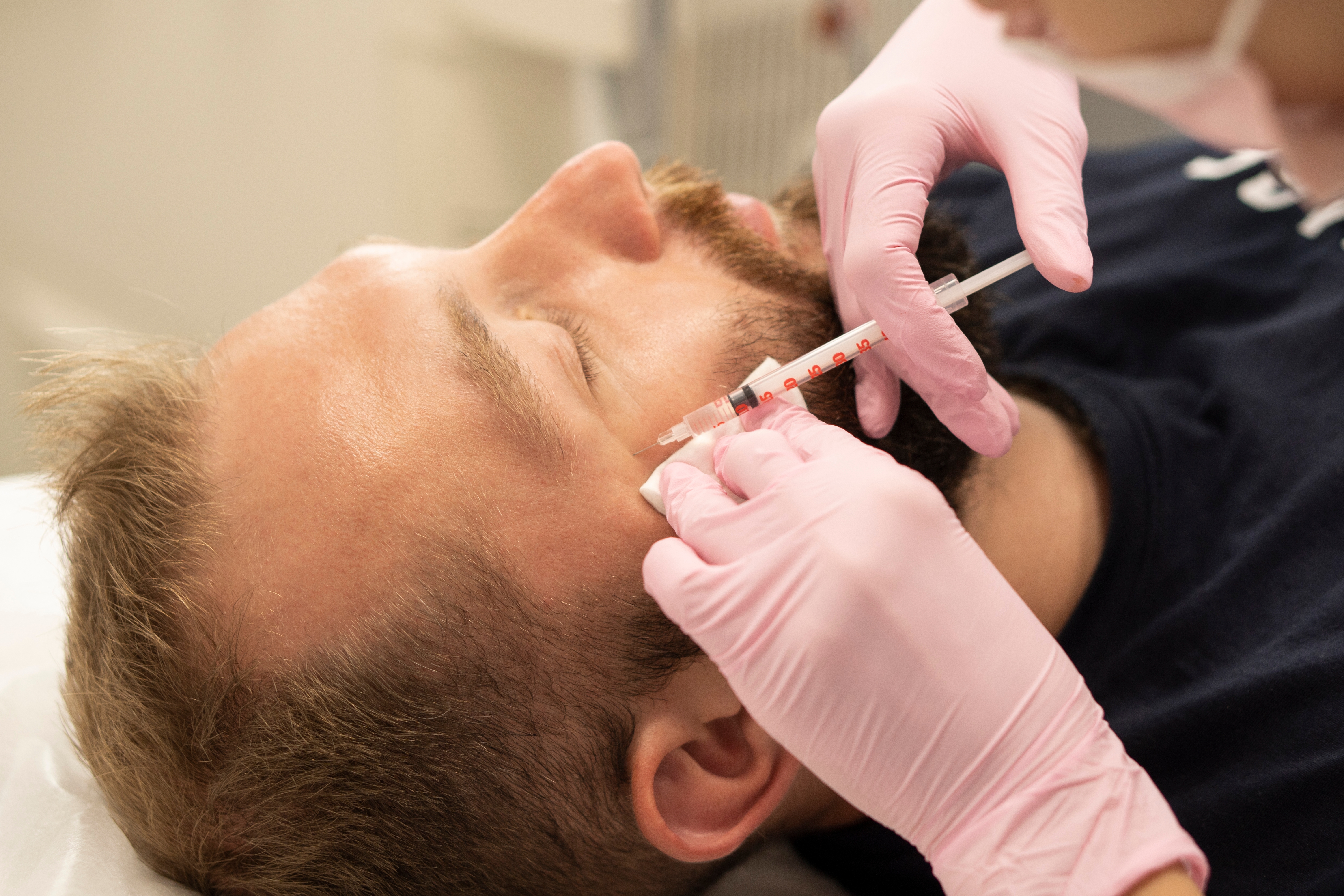 Man getting botox cosmetic near crows feet
