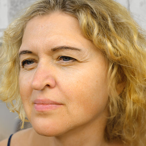 woman with drooping eyelid