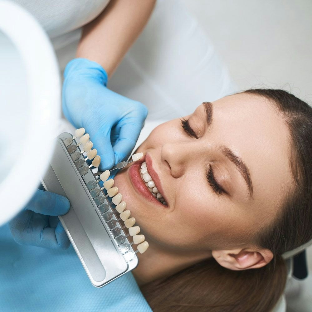 Veneer patient and shade guide next to teeth