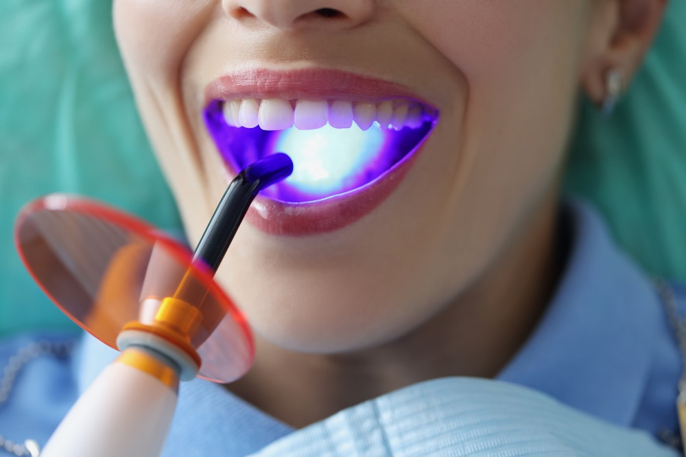 Teeth Deep Cleaning – Everything You Need to Know - Bright Smile Dental  Powell