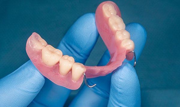 Partial denture in gloved hand
