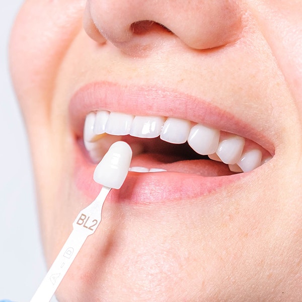 Crown next to woman's smile