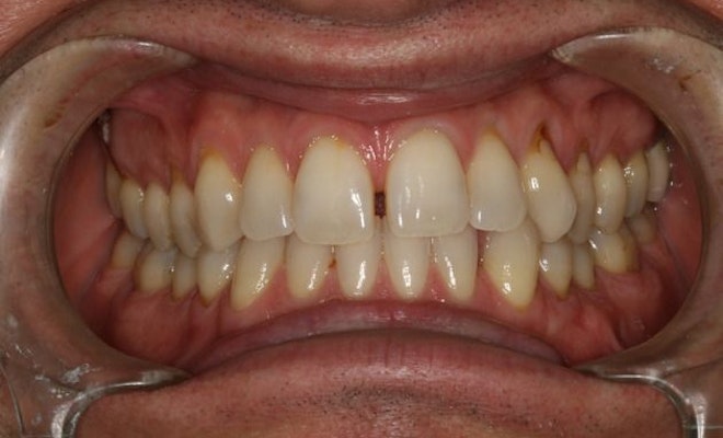 Before a smile makeover
