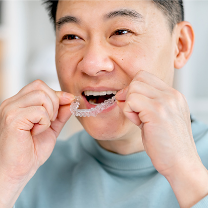 man putting in aligners