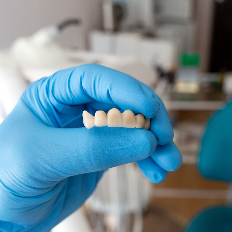 Dental bridge