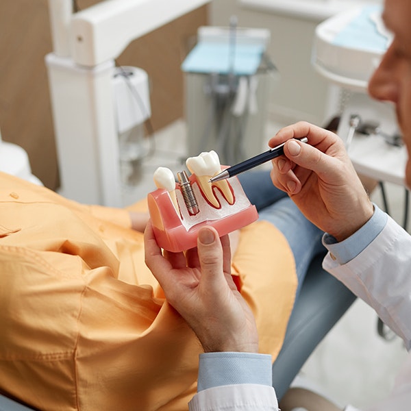 Dental Implant Restoration