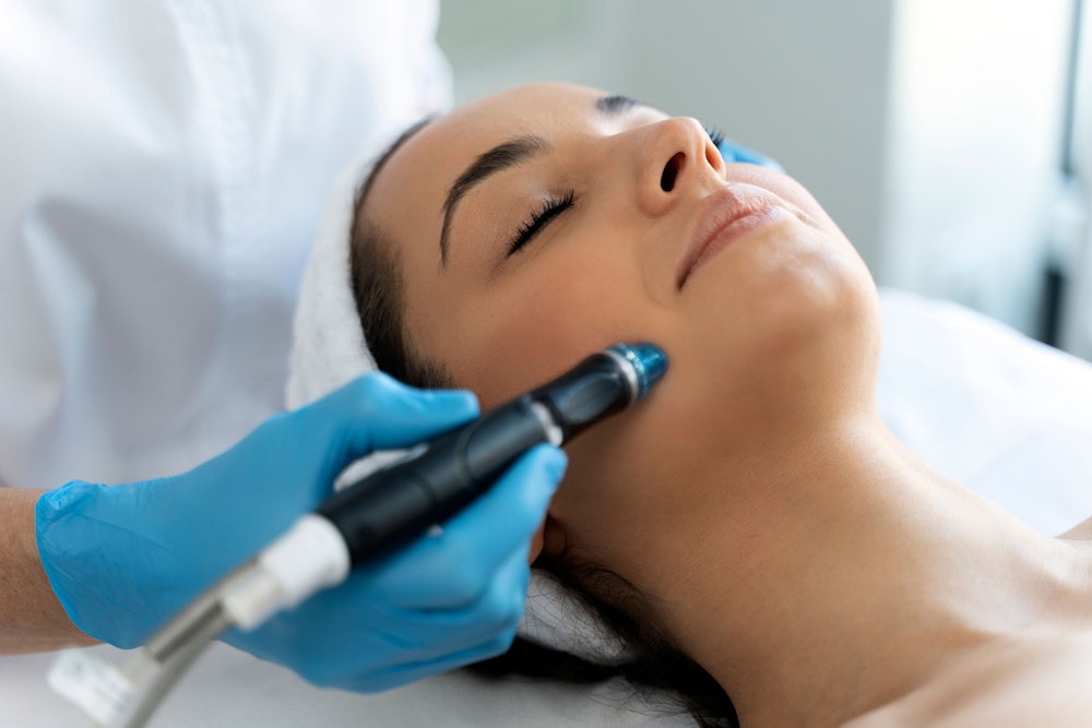 Microdermabrasion