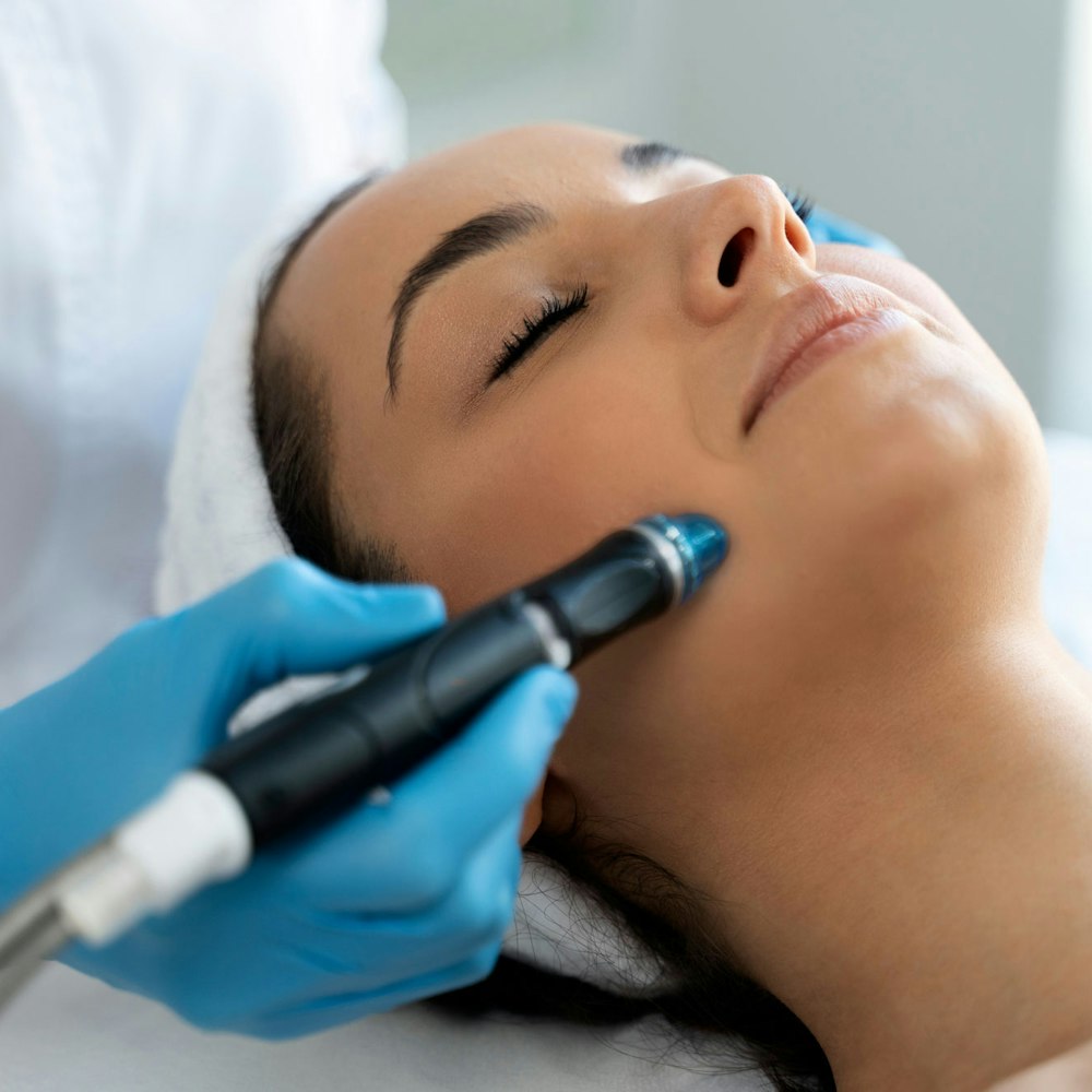 Microdermabrasion