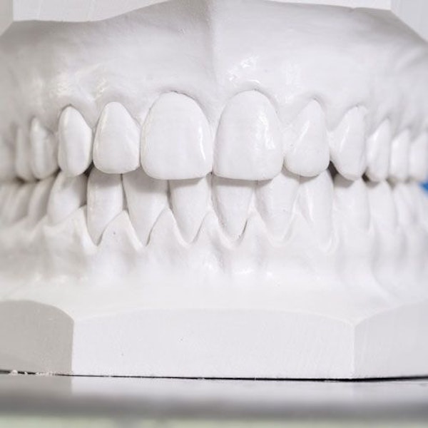 Physical Bite Modeling