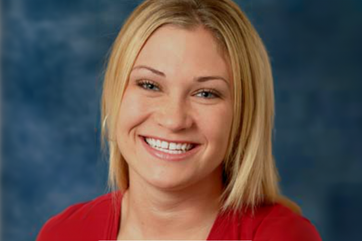 Patient before veneers