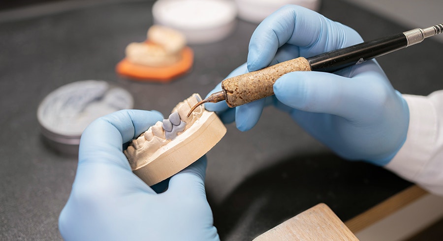 Dentist creating model of veneers