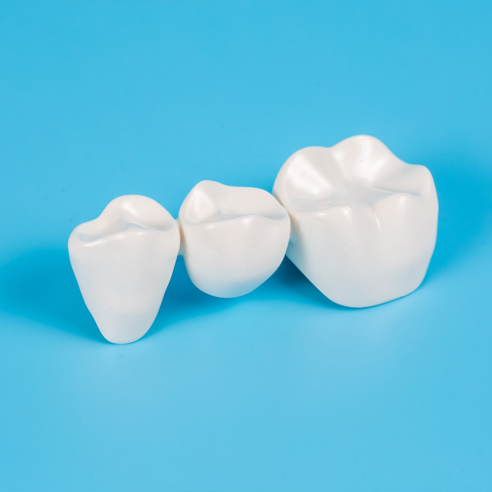 An illustration of the placement of a traditional bridge