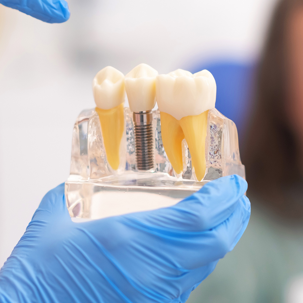 A dental implant, abutment, and crown