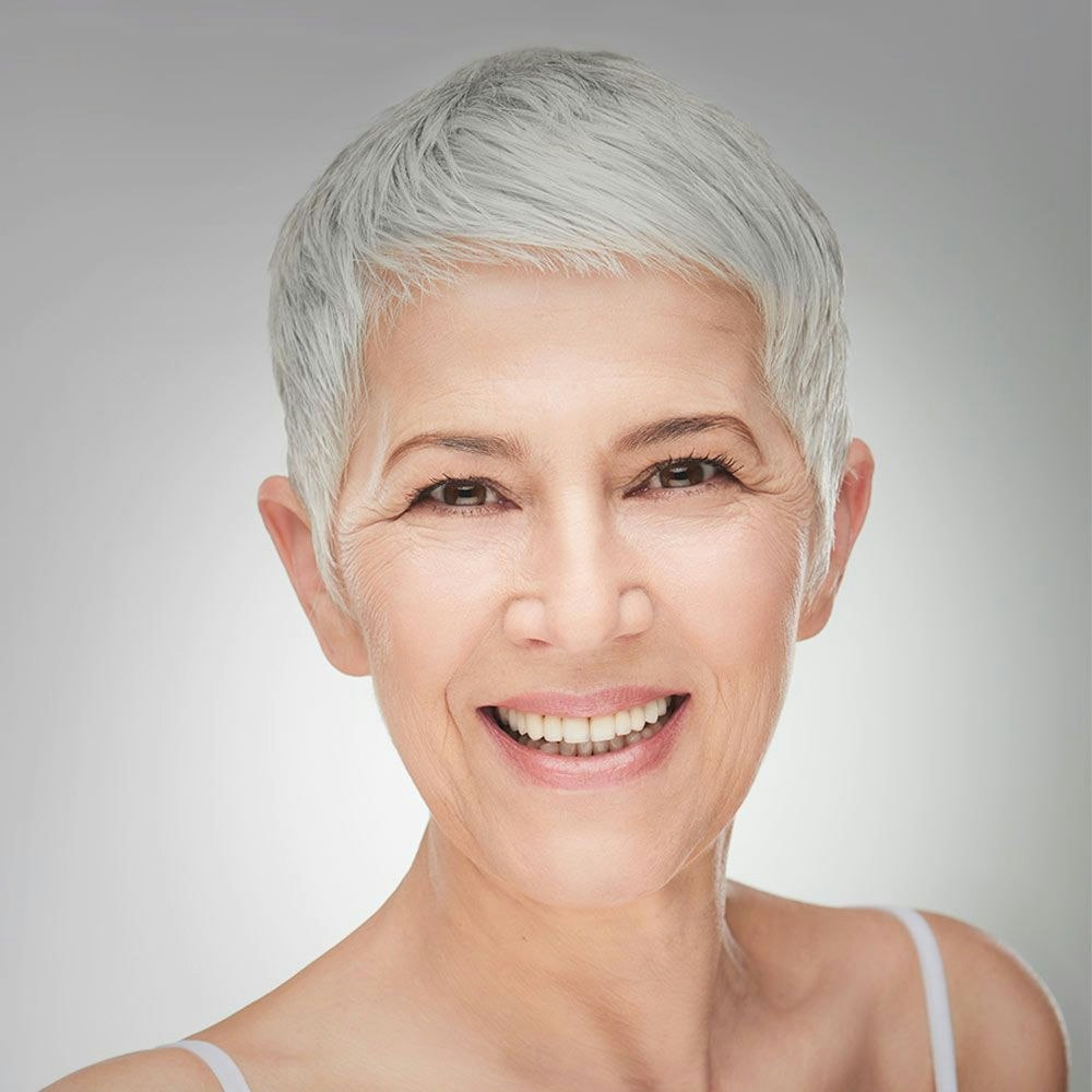 Woman looking down with her new blepharoplasty procedure done