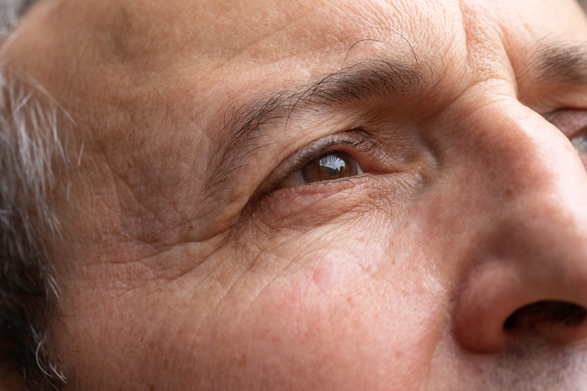 man with crow's feet