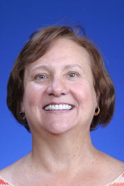 Patient after a smile makeover