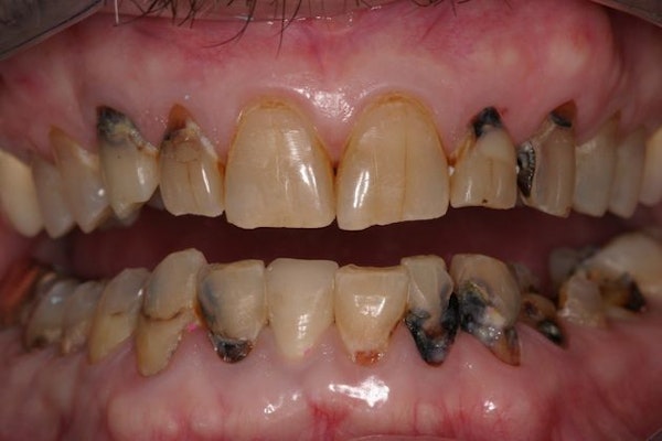 Before smile makeover