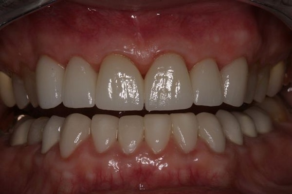 After smile makeover