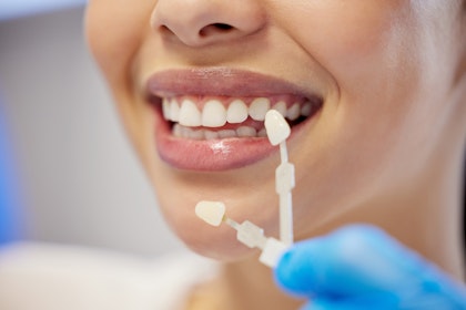 Shade testing a woman's teeth