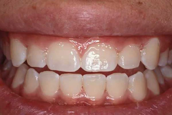 before dental treatment