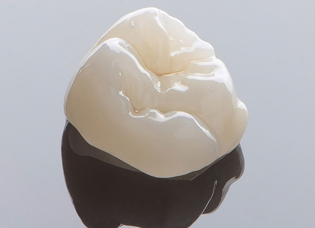 dental crown
