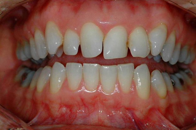 Before smile makeover