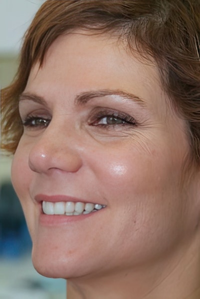 smiling woman after smile makeover