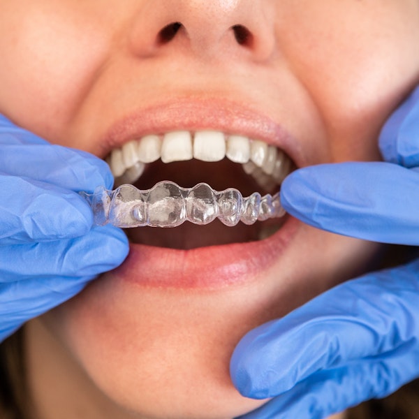 Dentist placing patient's Invisalign tray 