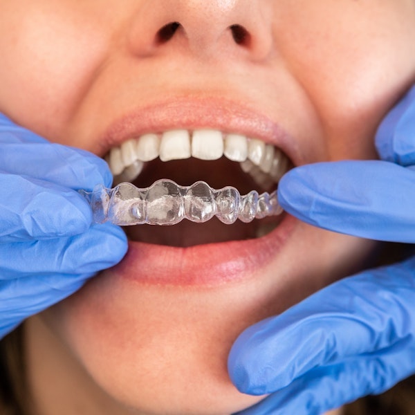 Dentist placing patient's Invisalign tray 