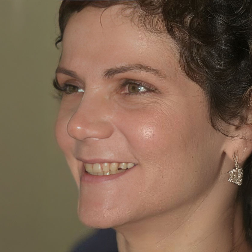 Smile makeover before photo