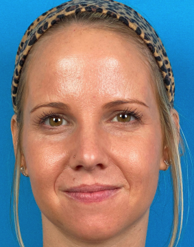 Woman with clear skin