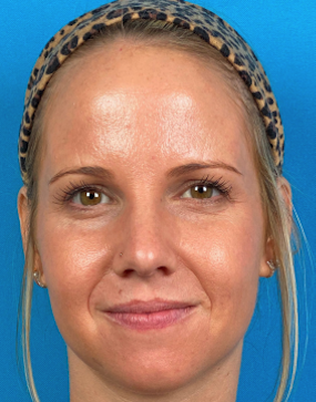 Woman with clear skin