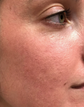 Woman with smooth skin