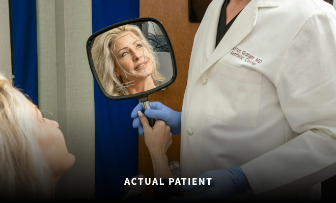 Patient looking in mirror